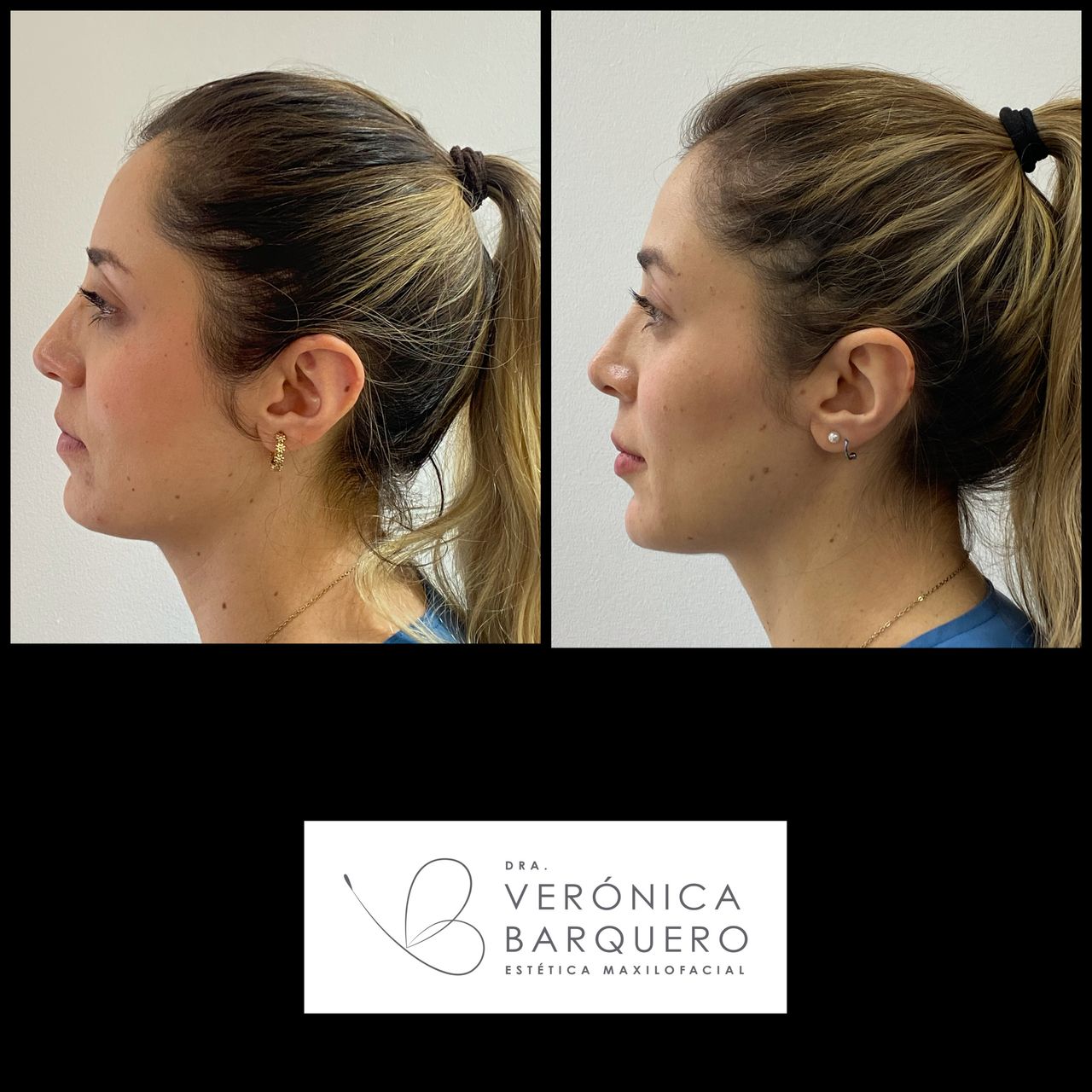 Veronica Maria Barquero Figueroa-13
