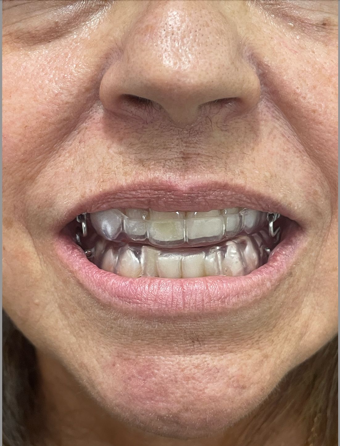 Leonardo Monteiro-19