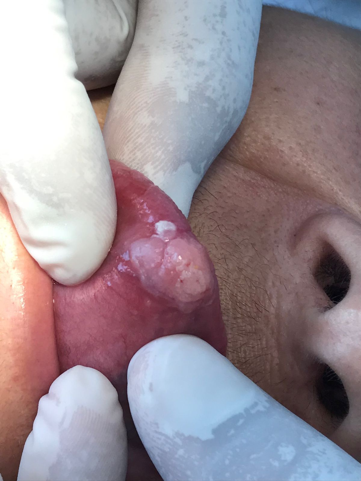 Francisco De Assis Almeida Lima Júnior-16