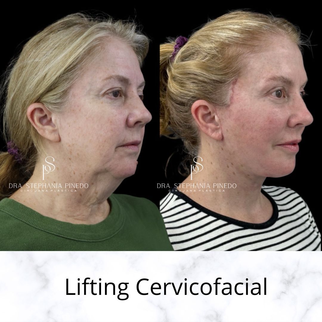 Stephanía Pinedo García-5