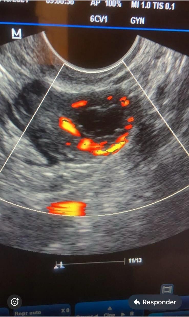 Jaqueline Rapoport-1