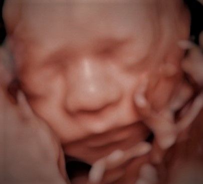 Charles Schwantz De Lima-3