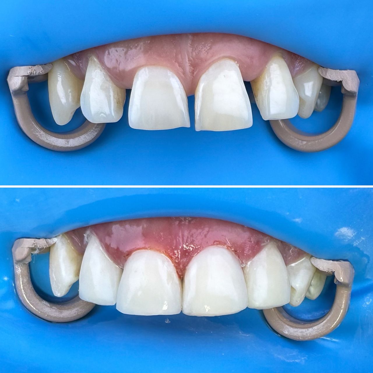 Camila Morales Cespedes-4