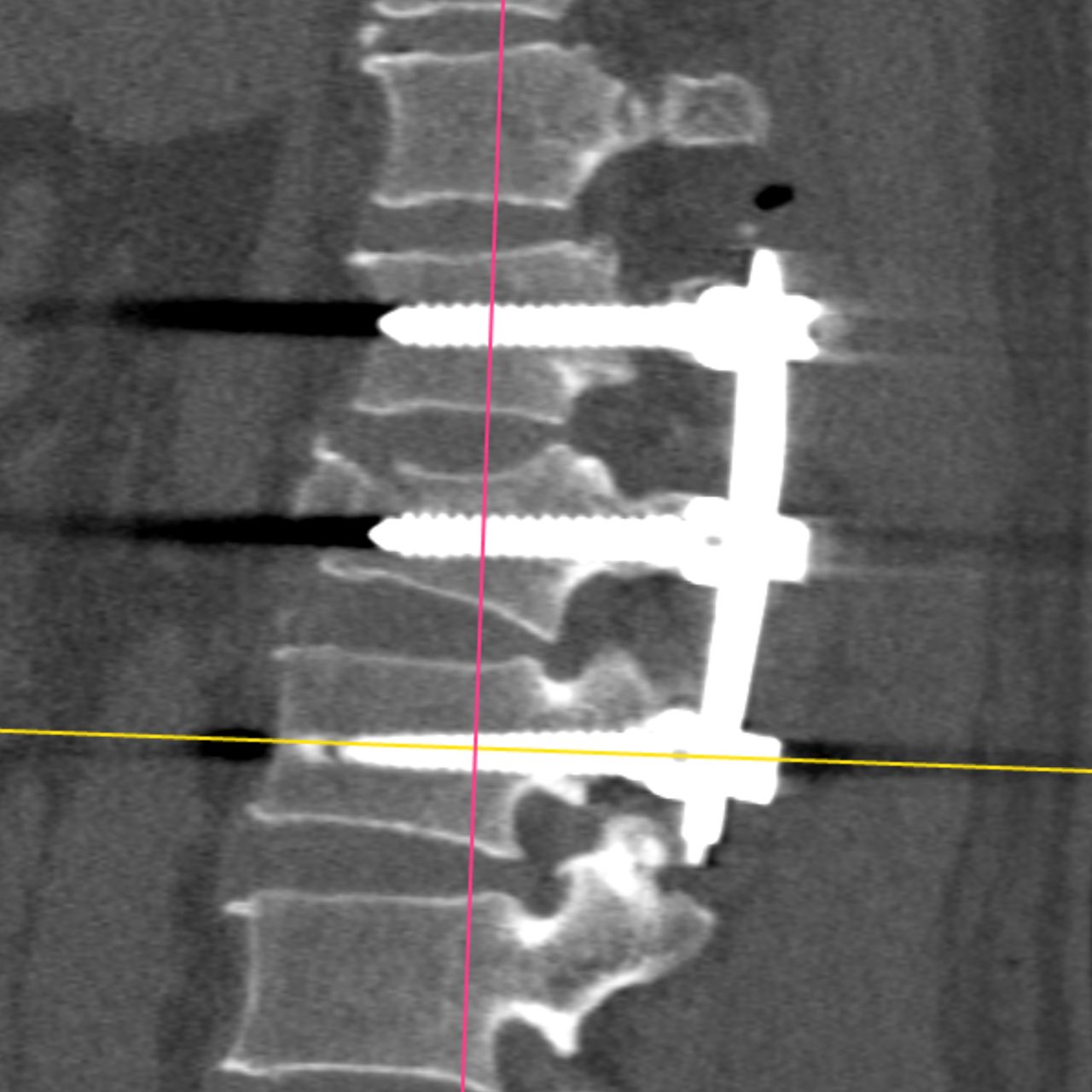 David Tafur Muñoz-1177