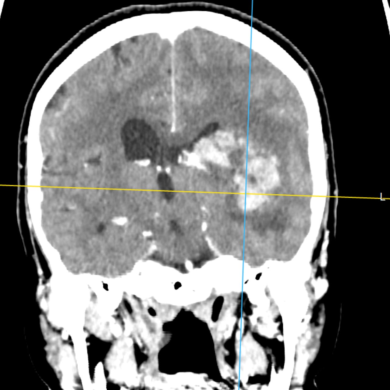 David Tafur Muñoz-1804