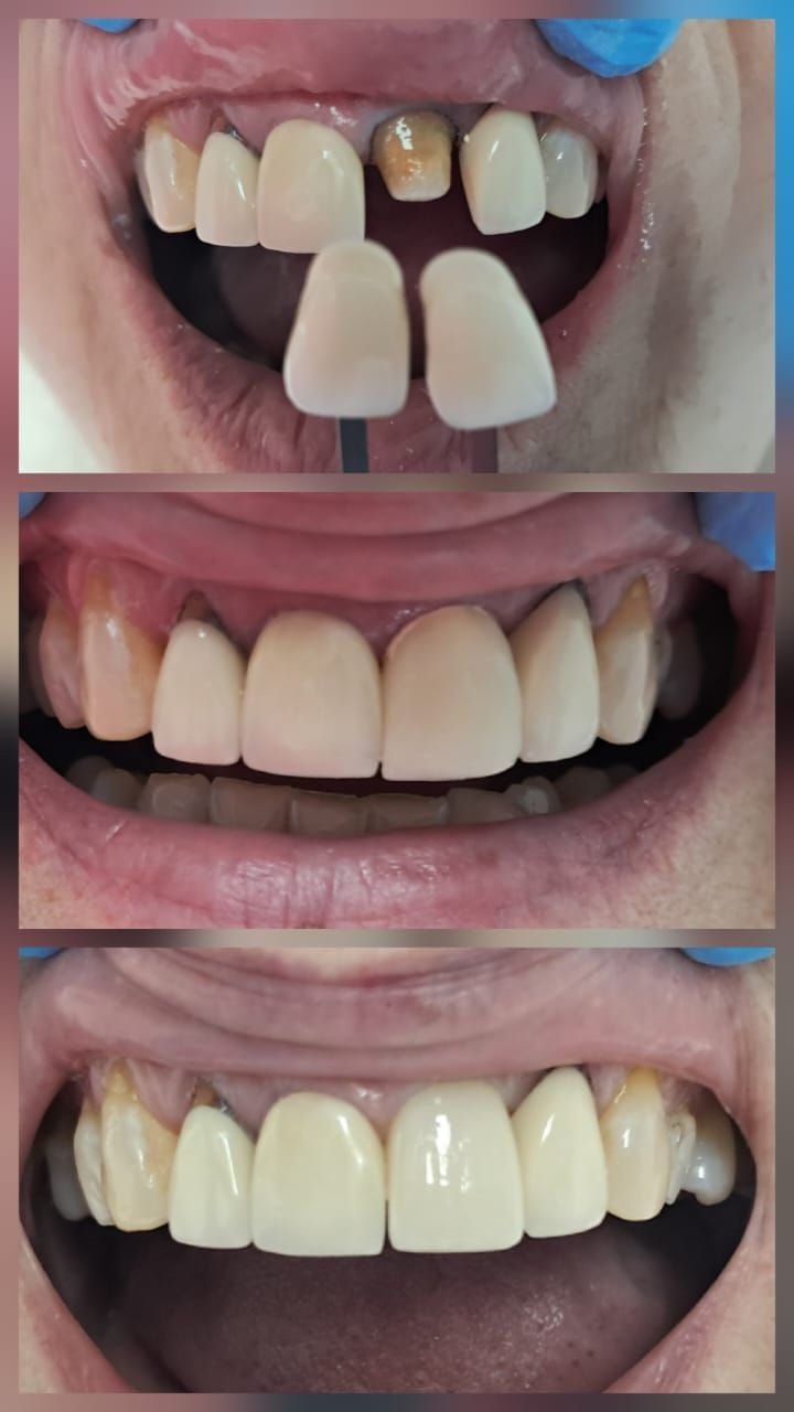 Yuset Almeida Urquiaga-0