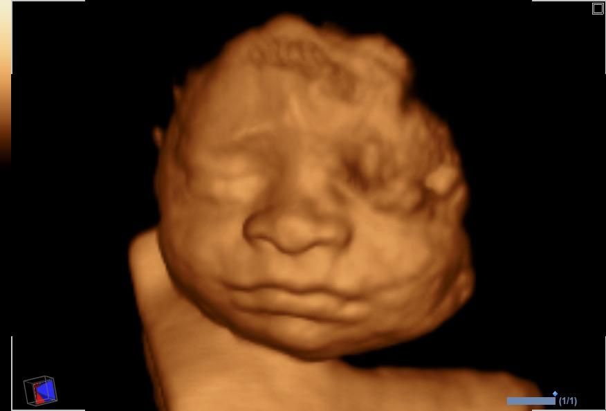 Benjamín Villarroel Castillo-15