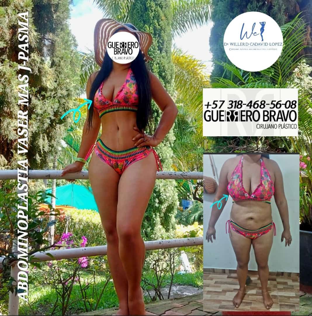 Camilo Guerrero Bravo-30