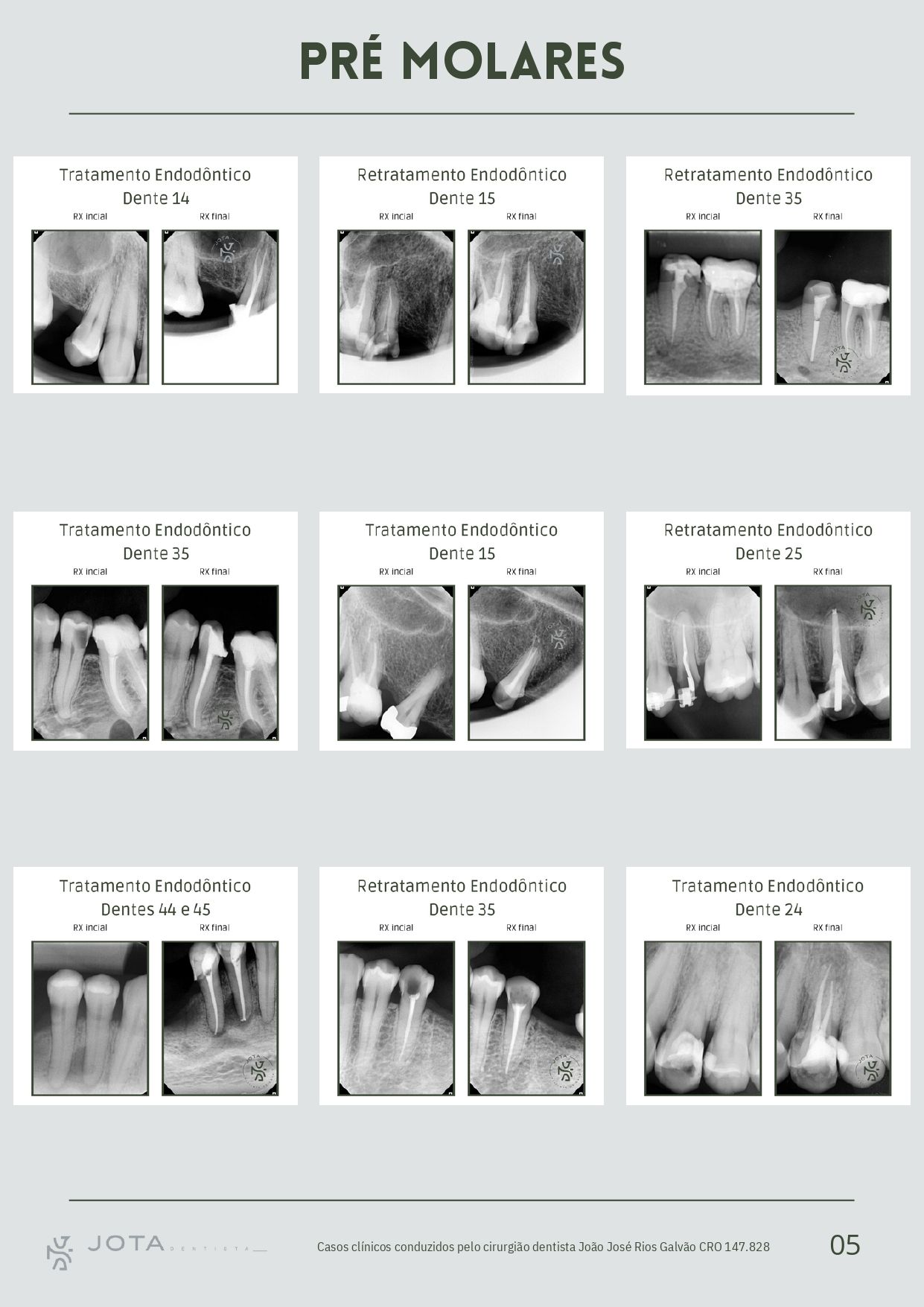 João  Rios Galvão-5