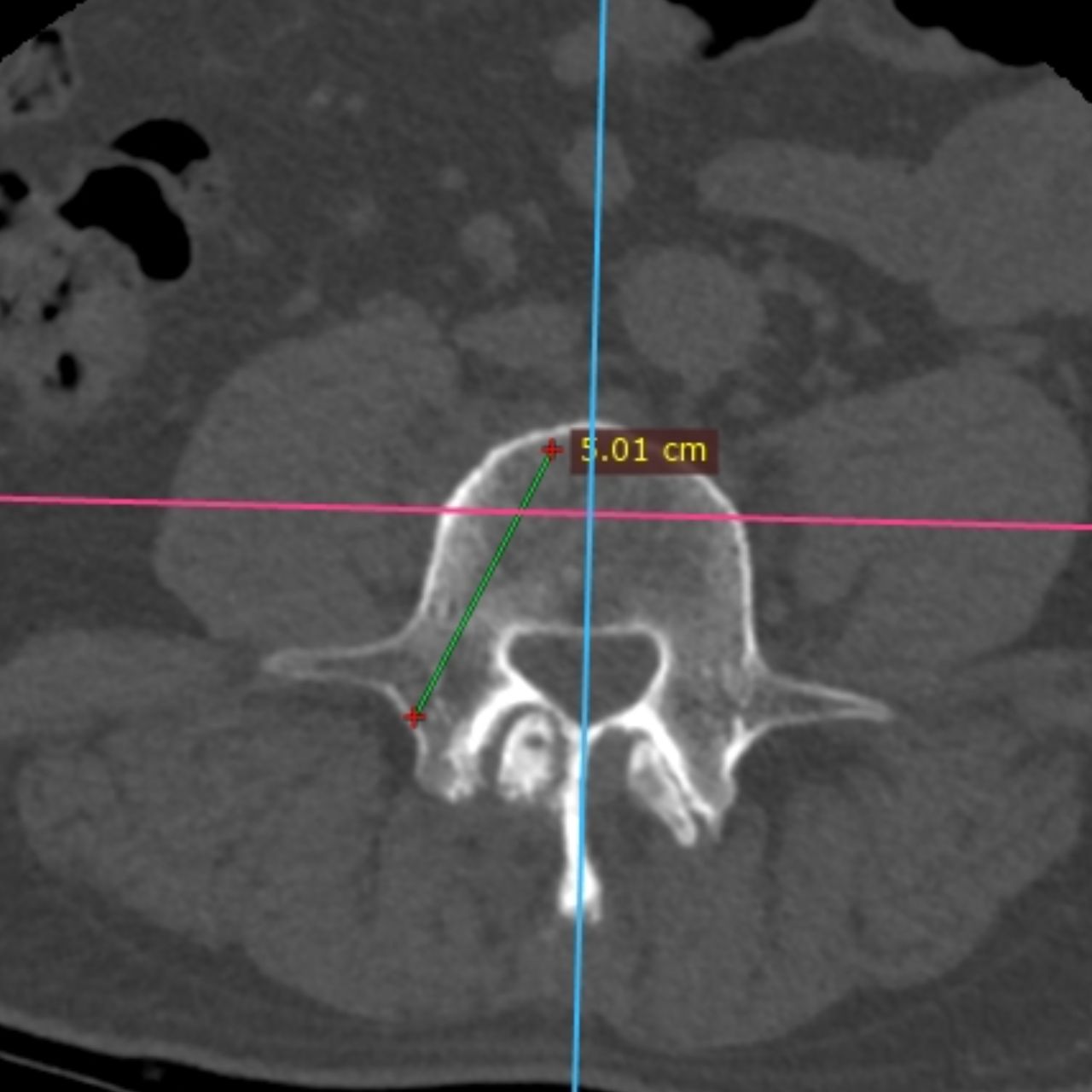 David Tafur Muñoz-1596