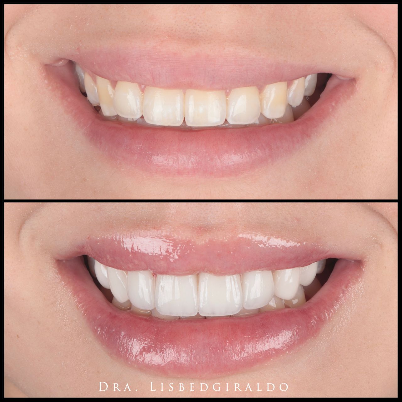 Lisbed Giraldo Olarte-16