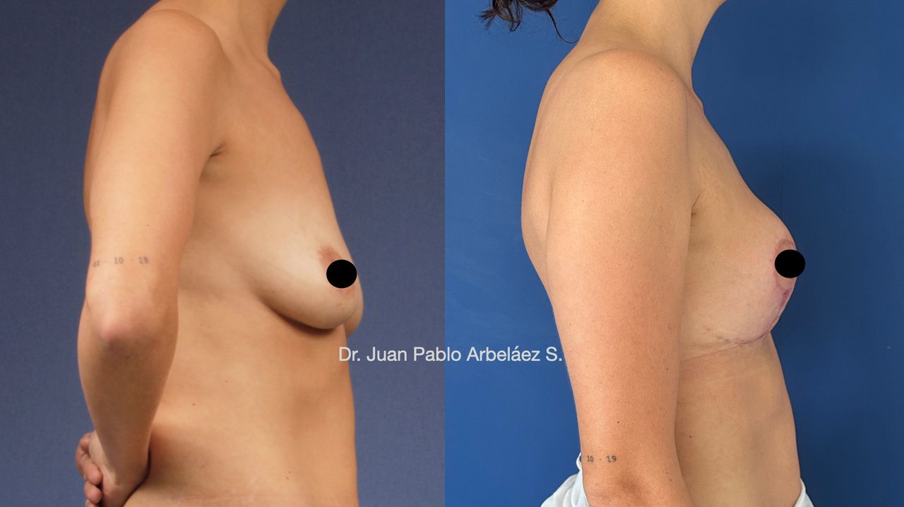 Juan Pablo Arbeláez Sierra-22