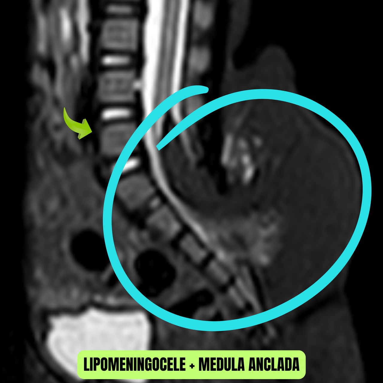 David Tafur Muñoz-2157