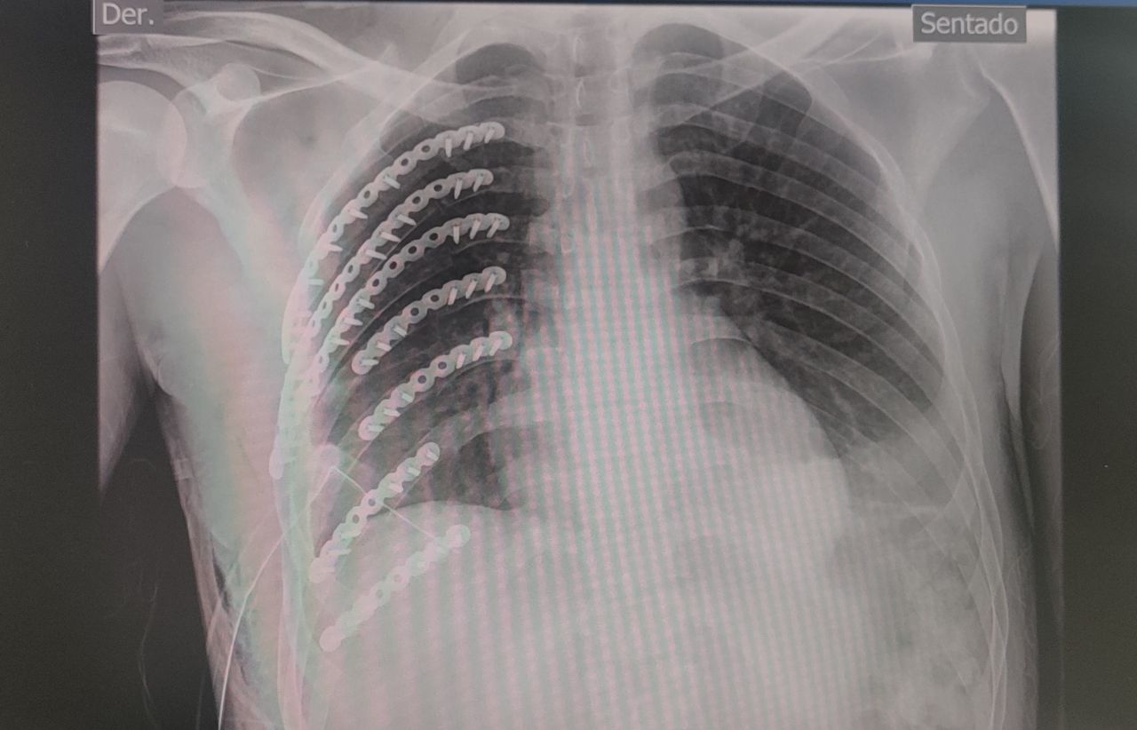 Willfredy Castaño Ruiz-20