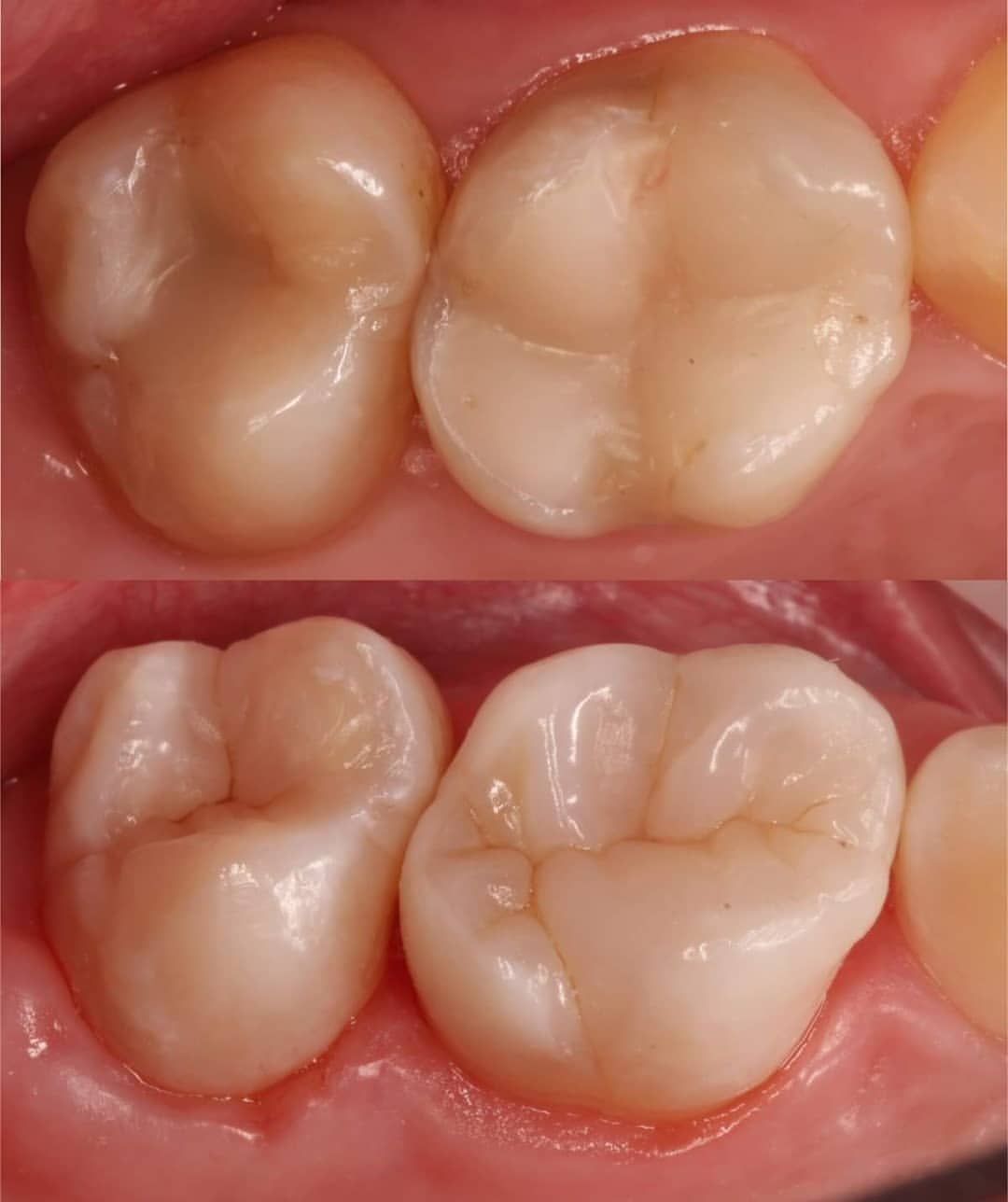 Alejandro Martinez-8