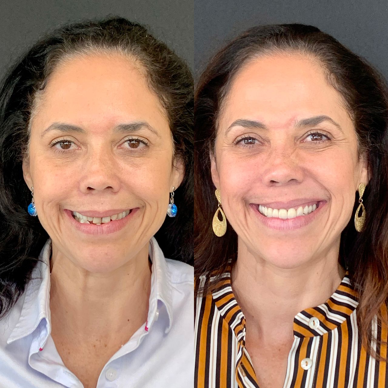 Gisele De Carvalho Versannio-19