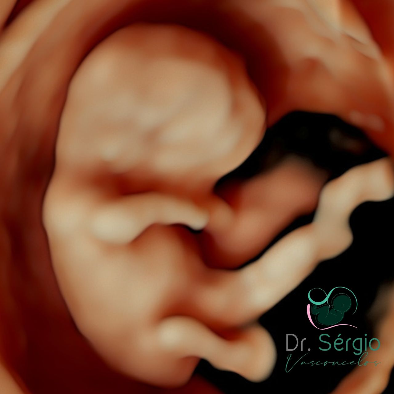 Sérgio De Abreu Vasconcelos Neto-15