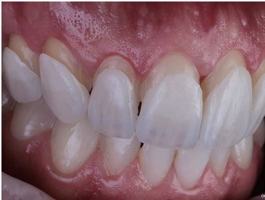 Juliana Pelegrini-12