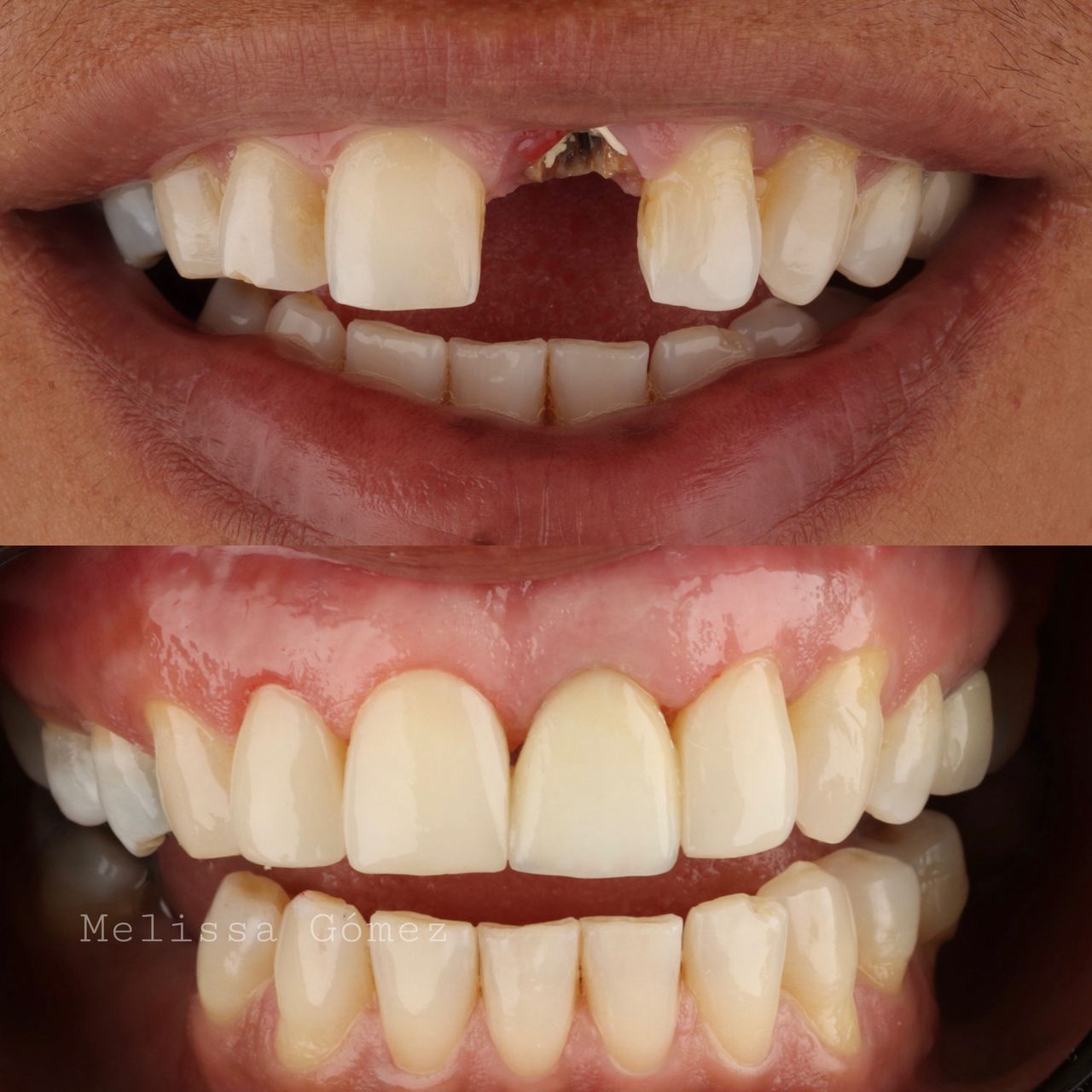 Melissa Gómez Arango-14