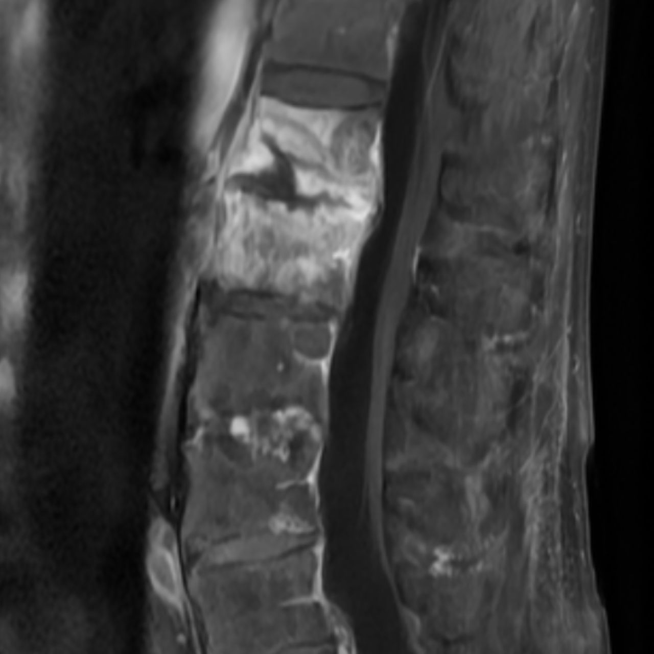 David Tafur Muñoz-1986