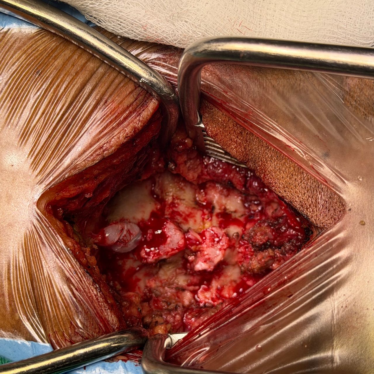 David Tafur Muñoz-2421