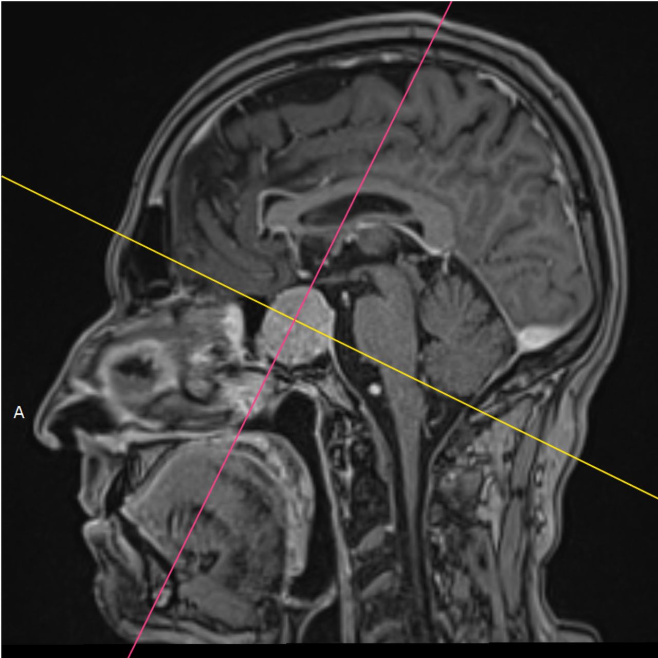 David Tafur Muñoz-1500