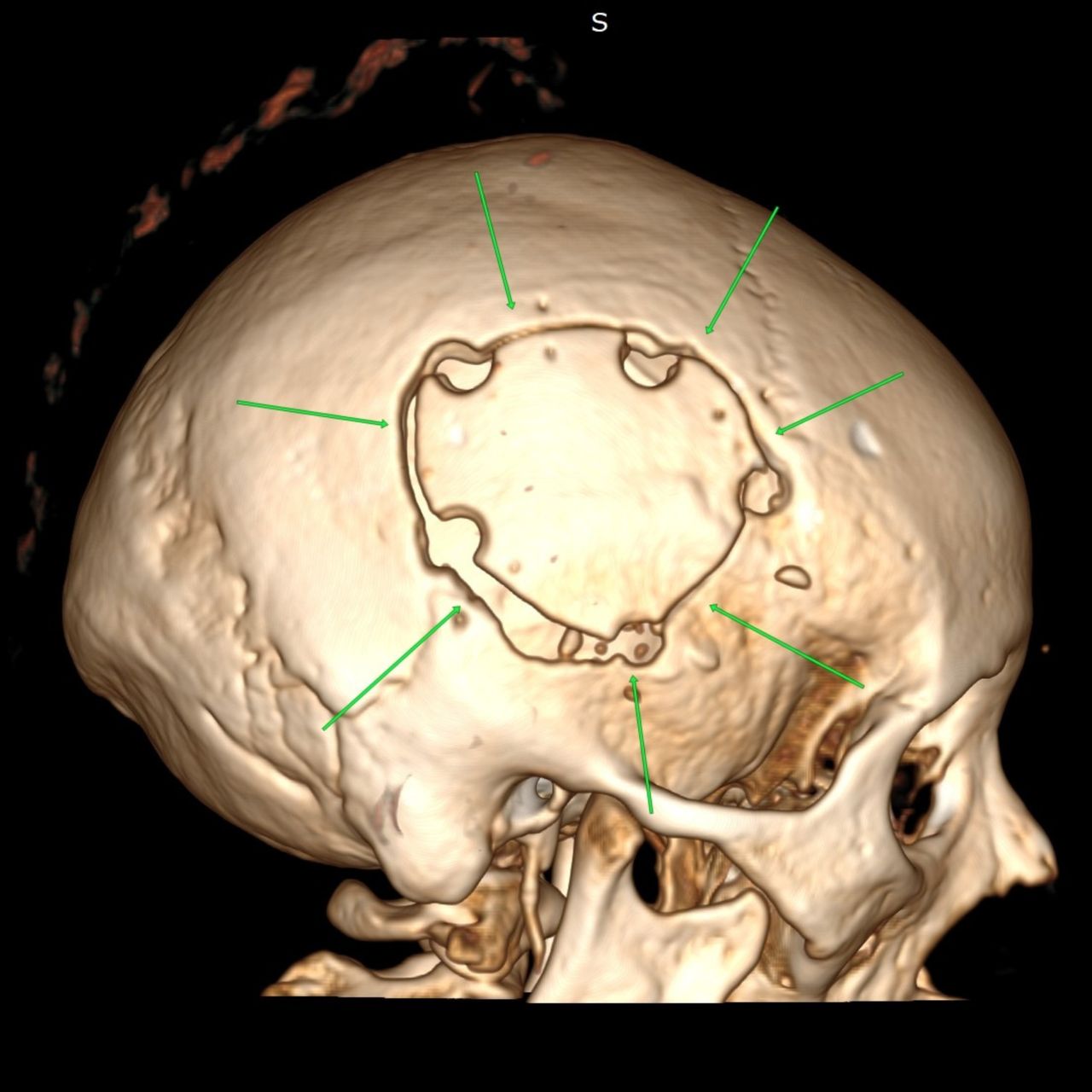 David Tafur Muñoz-1185