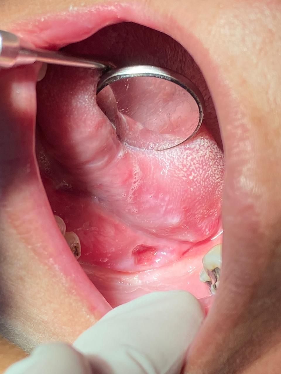 Francisco De Assis Almeida Lima Júnior-14