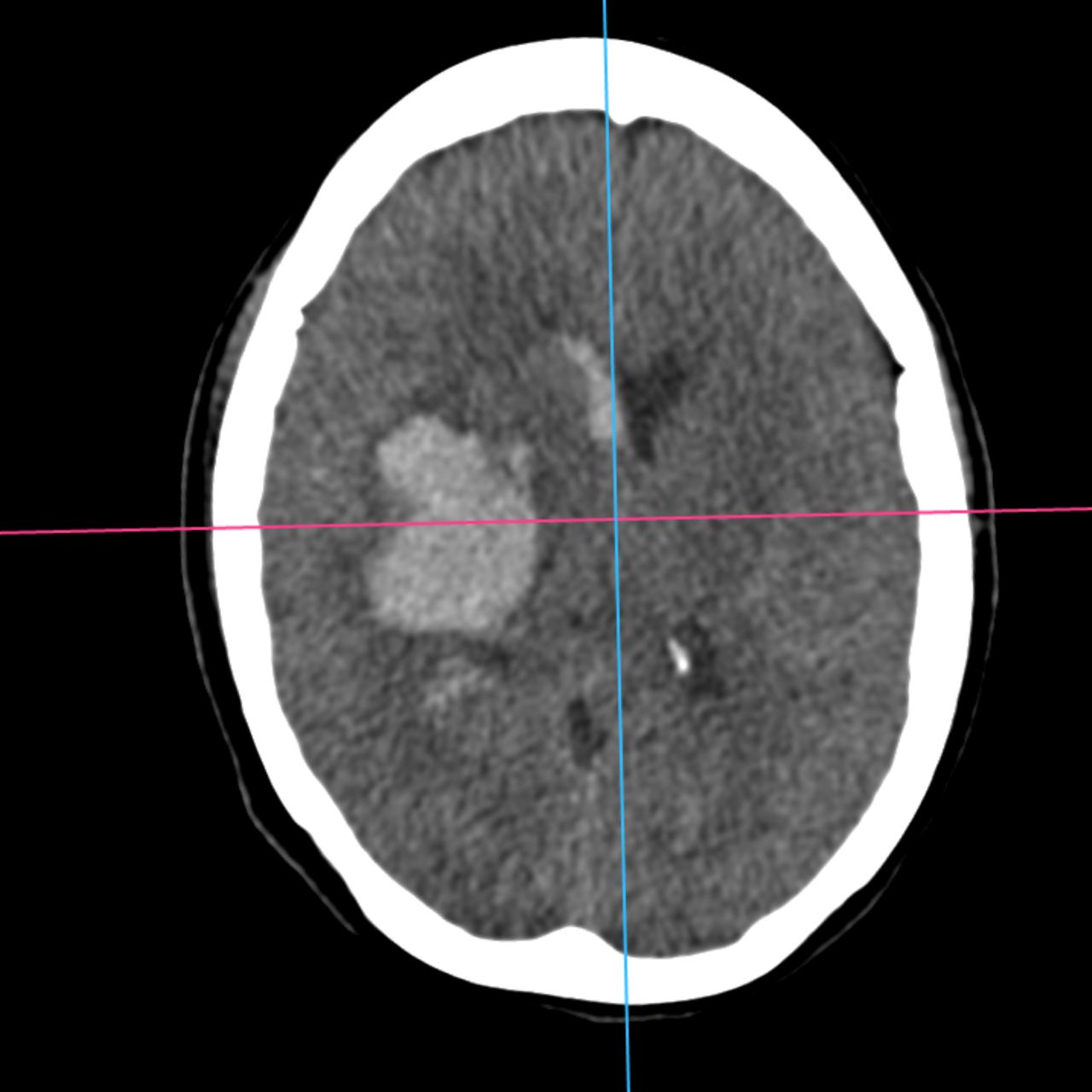 David Tafur Muñoz-2121