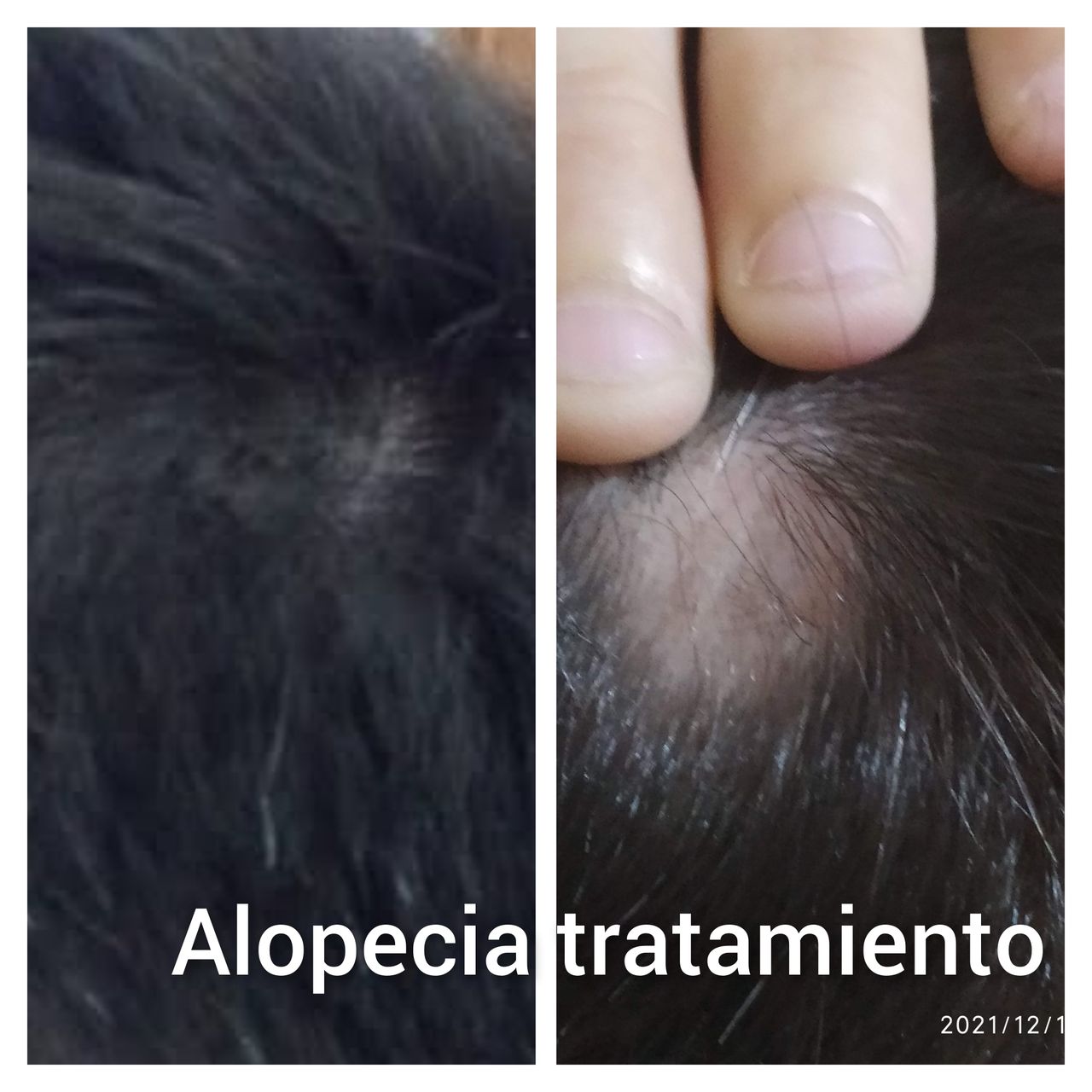 Alejandra Meijide-19