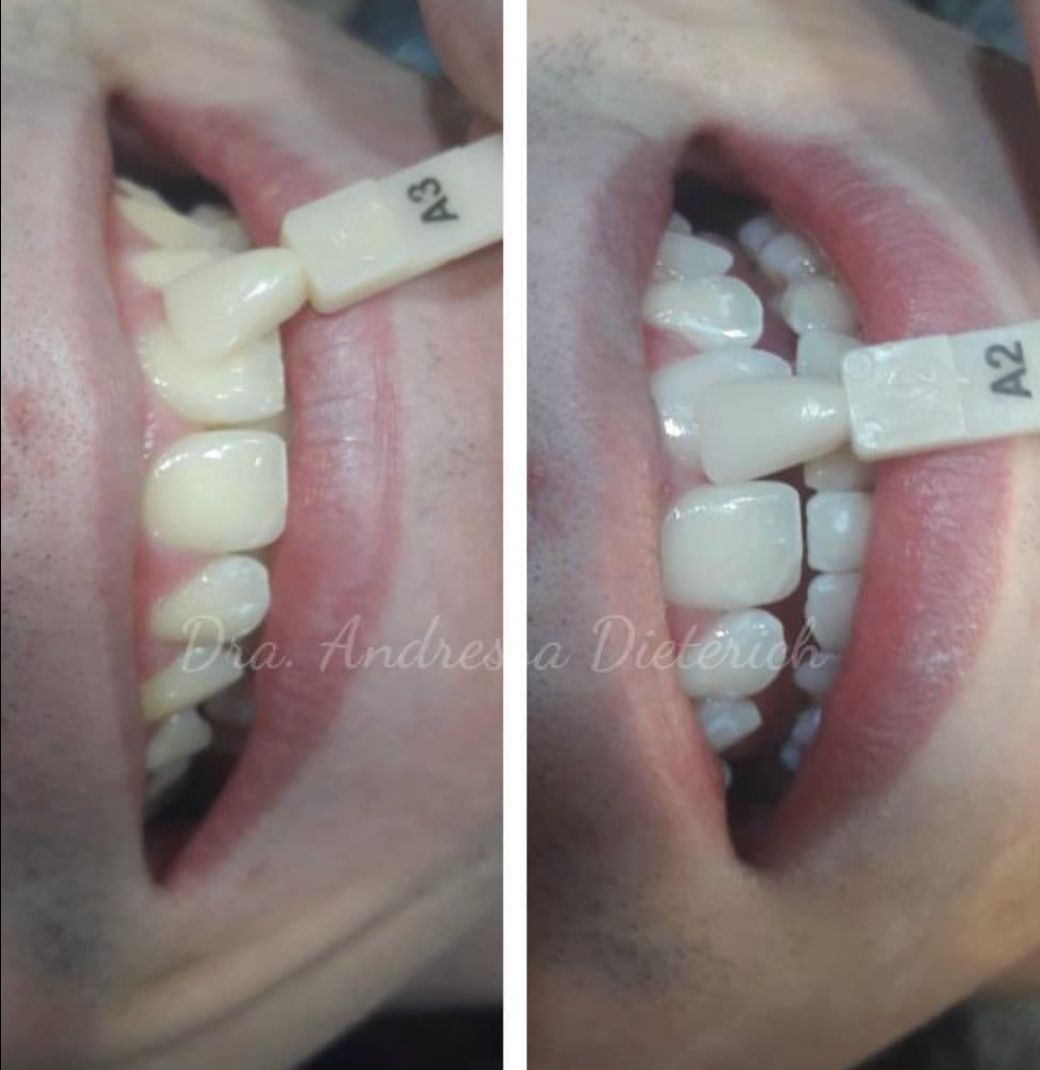 Andressa Dieterich-2