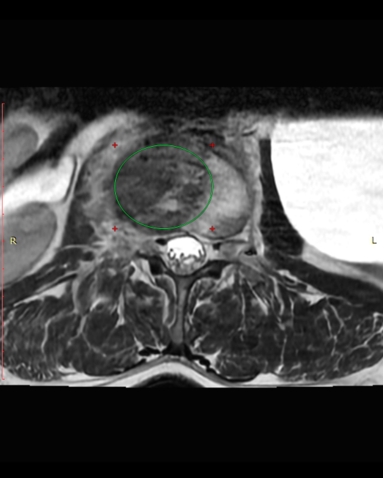 David Tafur Muñoz-2223