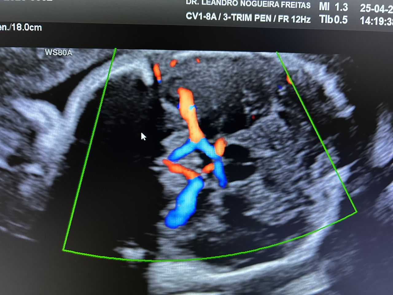 Leandro Nogueira Freitas-5