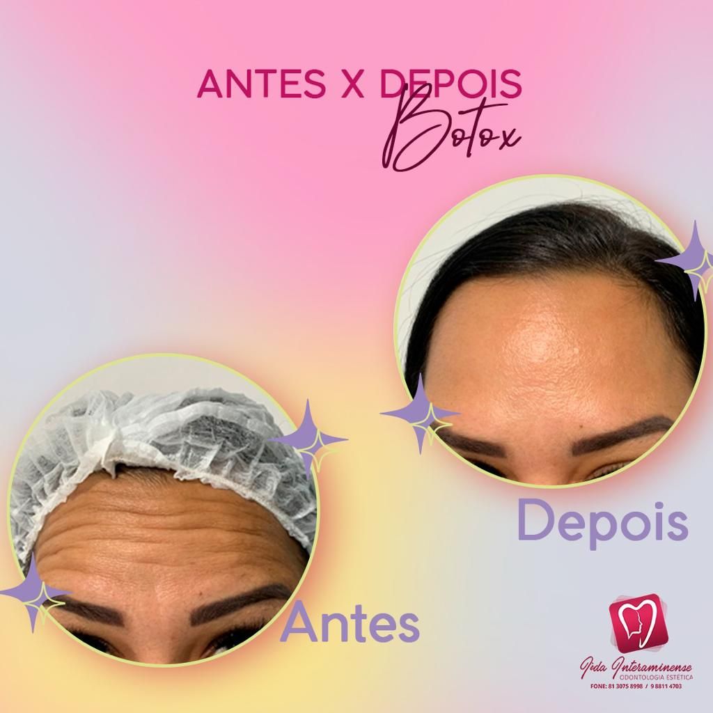 Iêda Interaminense-13