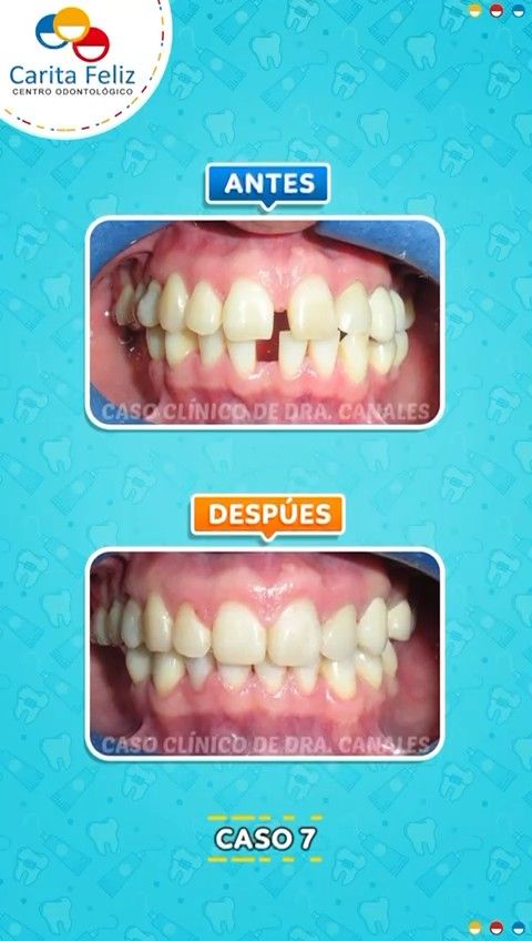 Angela Canales Larrea-4