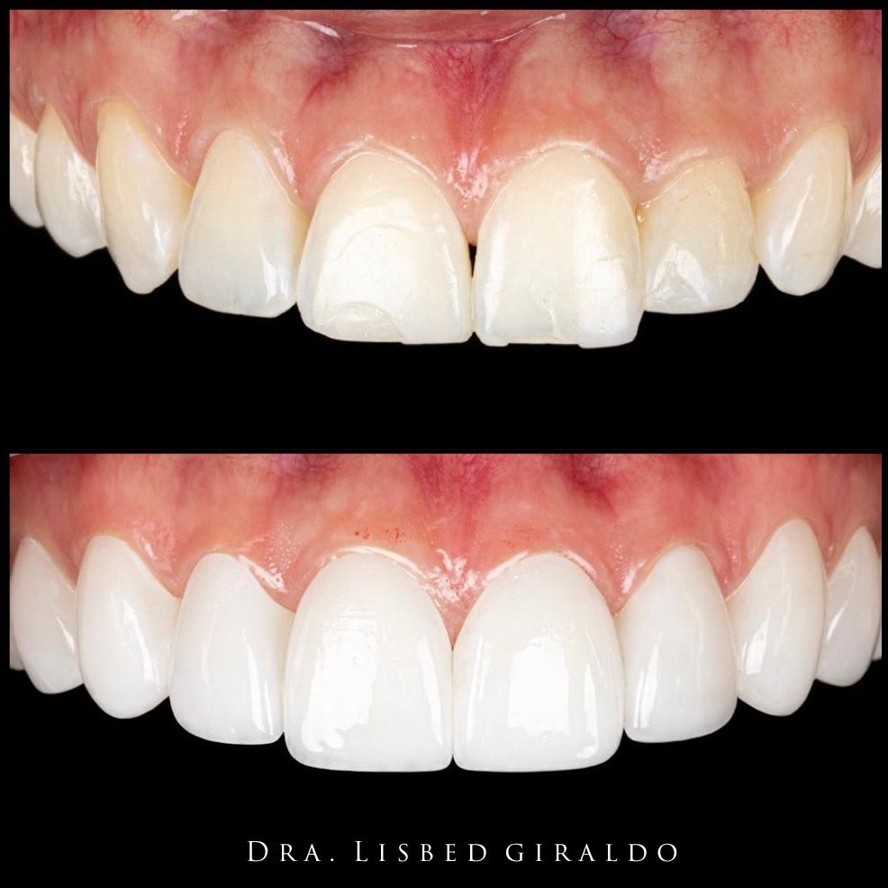 Lisbed Giraldo Olarte-15