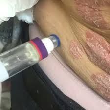 Antonio Carlos Biel-19