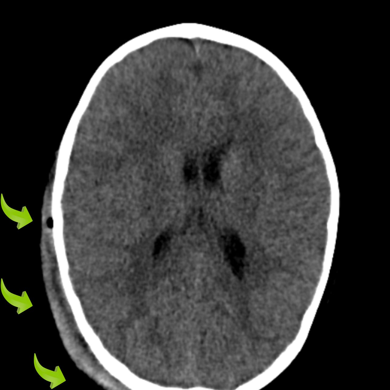 David Tafur Muñoz-1974