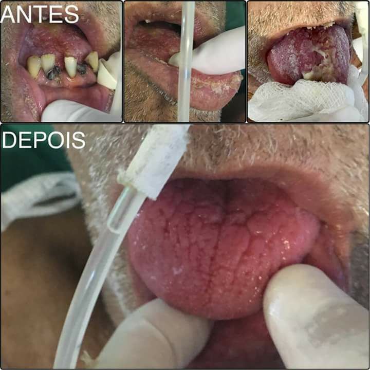 Alexandre Giannini-19