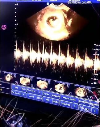 Yoice  Diaz Donoso-3