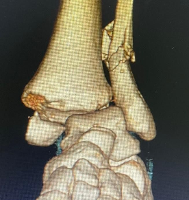 Jônatas Laurindo Giacomini-19