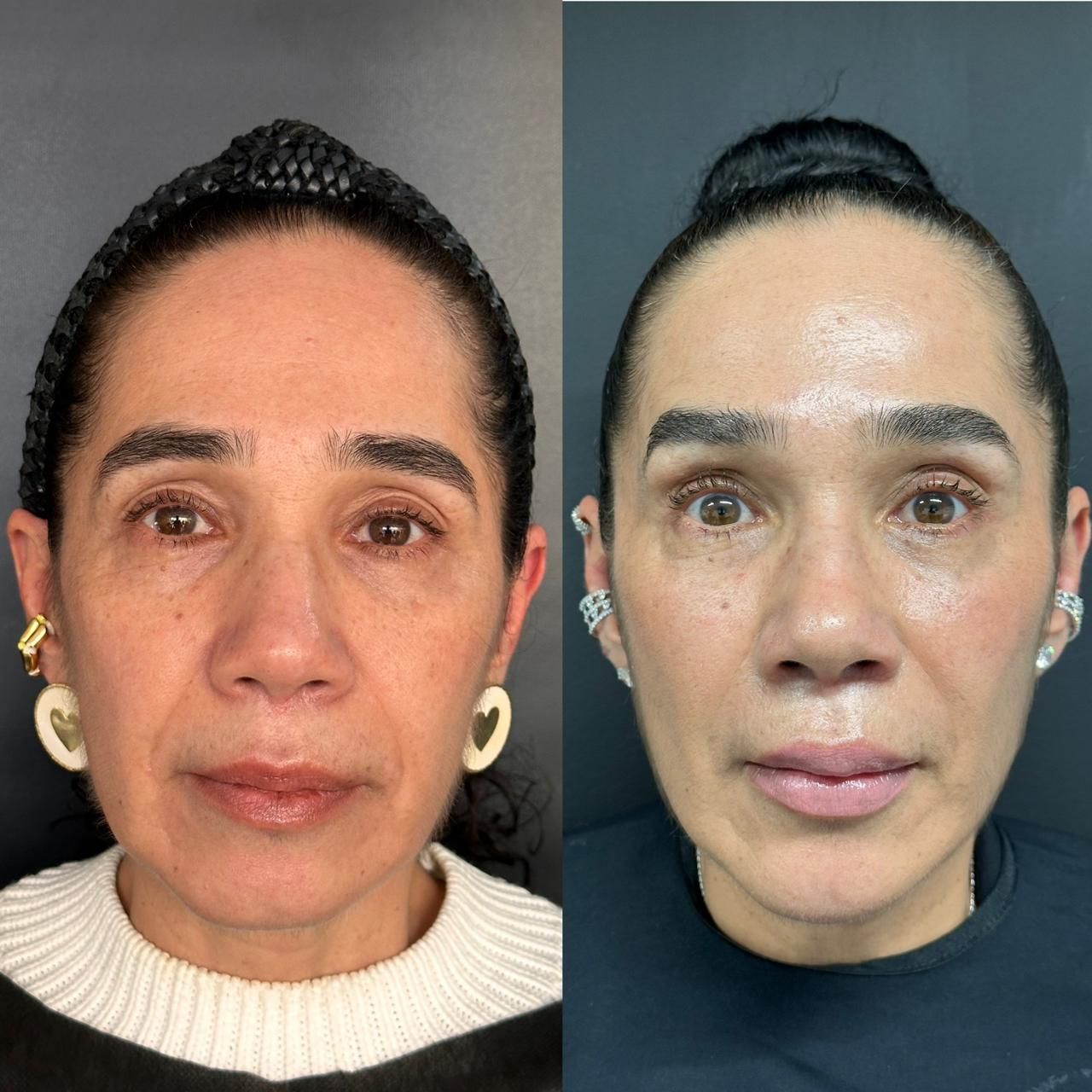 Andrés Felipe Barreto Galeano-29