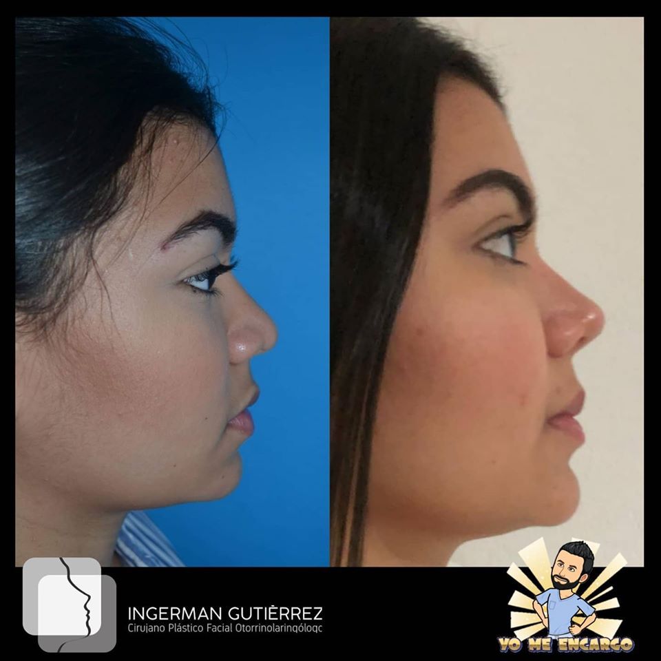 Ingerman Gutiérrez González-6