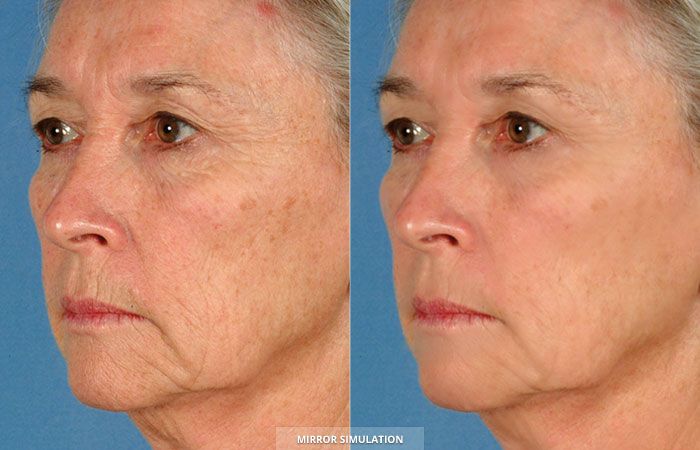 Rosicler Rocha Aiza Alvarez-4