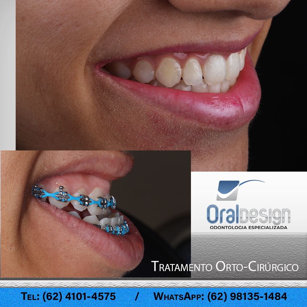 Danilo Monteiro Rezende Pereira-3