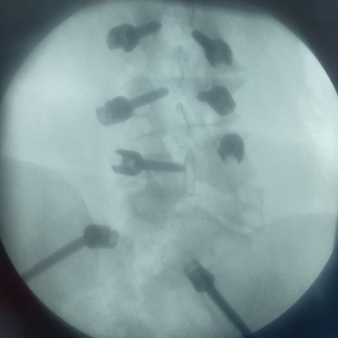 David Tafur Muñoz-2322