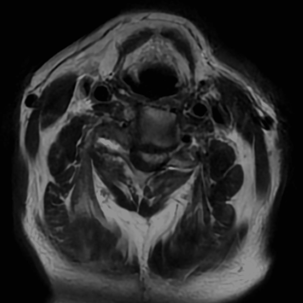 David Tafur Muñoz-2339