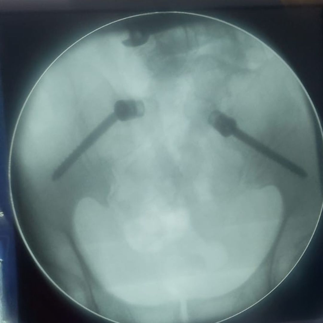 David Tafur Muñoz-2316