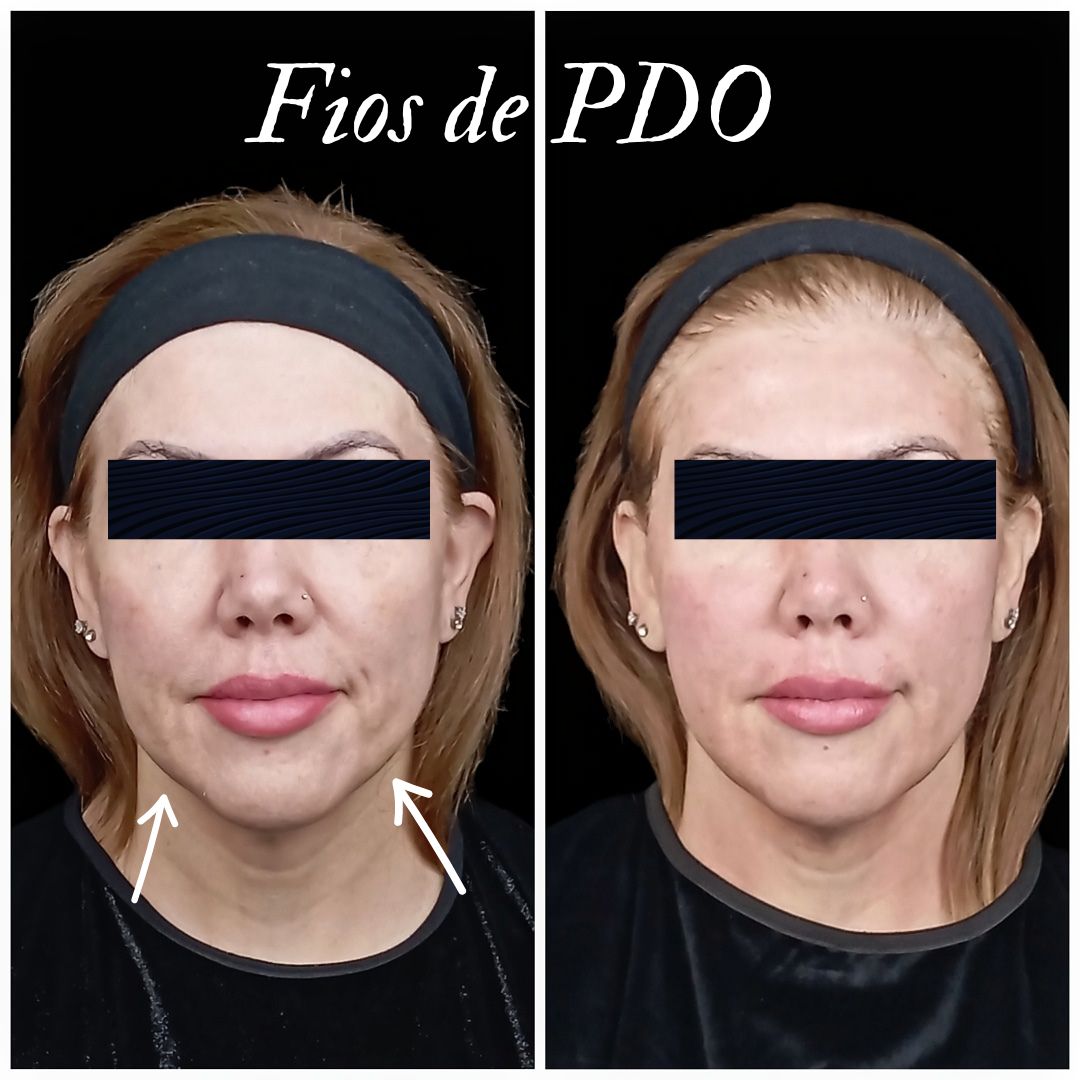 Catherine Ariadne De França  Valente-11