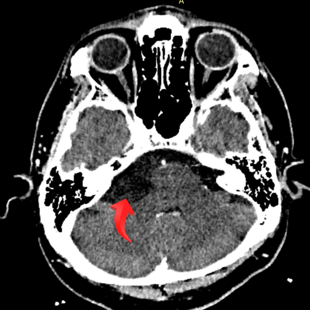 David Tafur Muñoz-2301